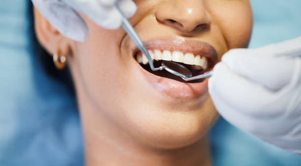 Best Emergency Root Canal Treatment in Sperry, OK